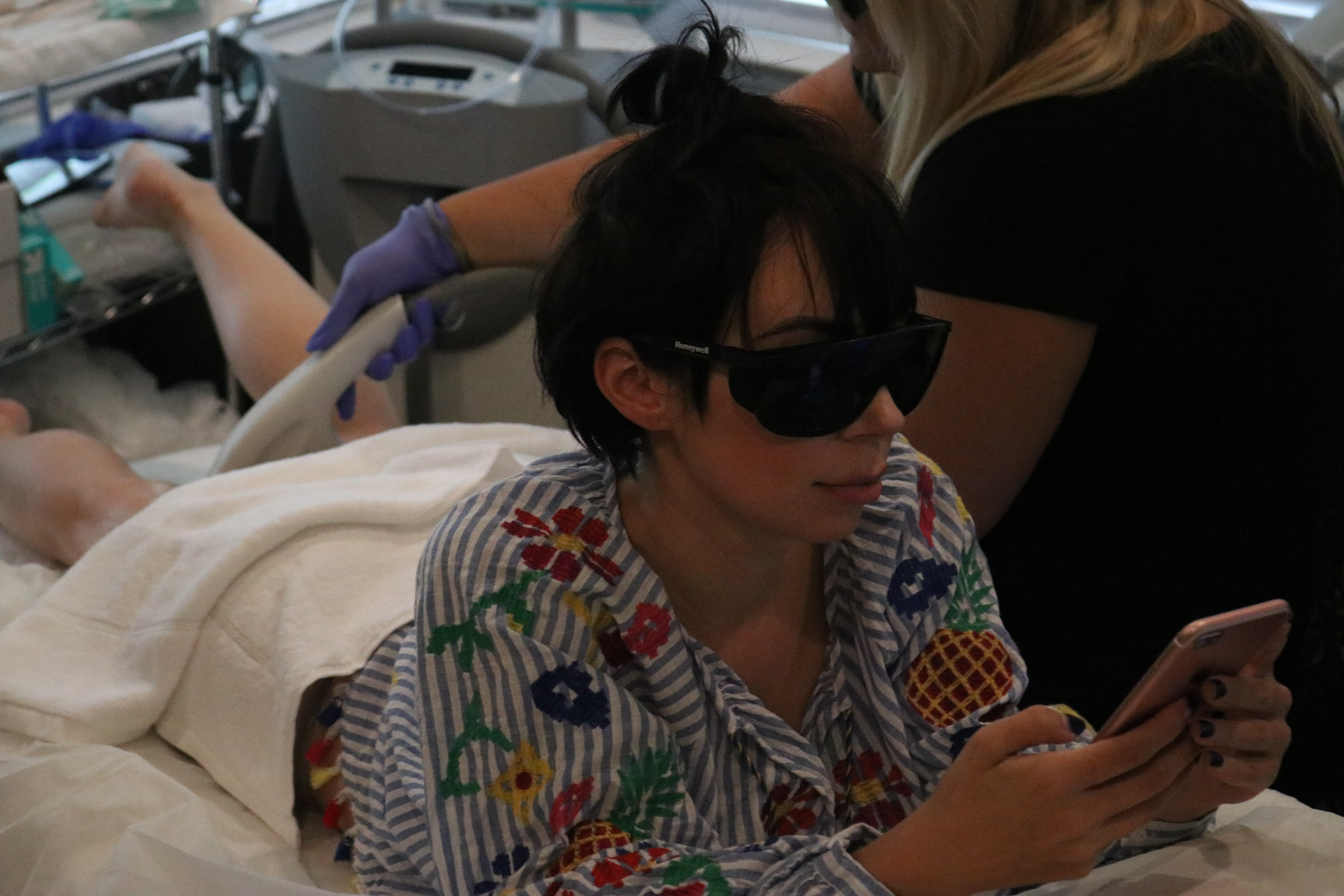 laser hair removal